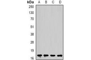 Western blot analysis of Cofilin 2 expression in Hela (A), mouse heart (B), rat kidney (C), rat brain (D) whole cell lysates. (Cofilin 2 抗体)