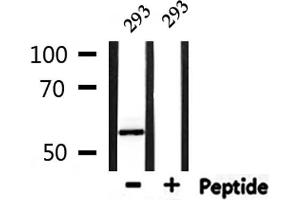 Western blot analysis of extracts from 293, using PFKFB1/4 Antibody. (PFKFB1/4 抗体)