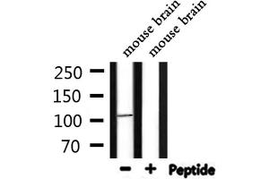 Western blot analysis of extracts from mouse brain, using TF3C3 Antibody. (GTF3C3 抗体)