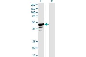 Western Blot analysis of NAPRT1 expression in transfected 293T cell line by NAPRT1 monoclonal antibody (M01), clone 4A9. (NAPRT1 抗体  (AA 1-466))