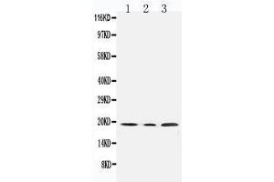 Western Blotting (WB) image for anti-Succinate Dehydrogenase Complex, Subunit C, Integral Membrane Protein, 15kDa (SDHC) (AA 35-50), (N-Term) antibody (ABIN3044203)