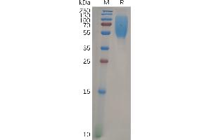 SDS-PAGE (SDS) image for Carcinoembryonic Antigen-Related Cell Adhesion Molecule 1 (CEACAM1) (AA 35-428) protein (His tag) (ABIN6964151)