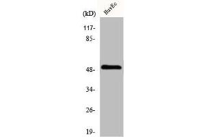 Western Blot analysis of HuvEc cells using IP3KA Polyclonal Antibody (ITPKA 抗体  (C-Term))