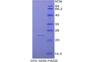SDS-PAGE of Protein Standard from the Kit (Highly purified E. (SUOX ELISA 试剂盒)