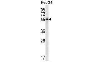 UGDH Antibody (C-term) western blot analysis in HepG2 cell line lysates (35 µg/lane). (UGDH 抗体  (C-Term))