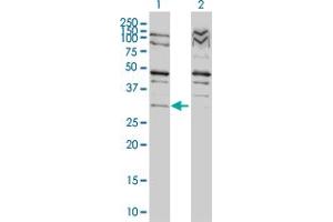 Western Blot analysis of TP53RK expression in transfected 293T cell line by TP53RK monoclonal antibody (M01), clone 4B9-1H3. (TP53RK 抗体  (AA 1-253))