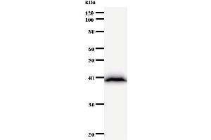 Western Blotting (WB) image for anti-Bromodomain Adjacent To Zinc Finger Domain, 1B (BAZ1B) antibody (ABIN930943) (BAZ1B 抗体)