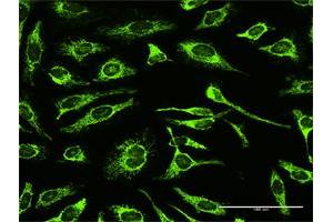 Immunofluorescence (IF) image for anti-TNF Receptor-Associated Protein 1 (TRAP1) (AA 1-704) antibody (ABIN950060)