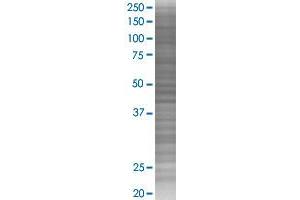 Western Blotting (WB) image for MAP3K14 293T Cell Transient Overexpression Lysate(Denatured) (ABIN1334361)