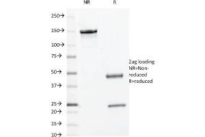 SDS-PAGE Analysis Purified c-Myc Mouse Monoclonal Antibody (9E10. (Myc Tag 抗体  (C-Term))