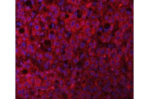 IF analysis of RAB3GAP1 using anti-RAB3GAP1 antibody (ABIN7599702).