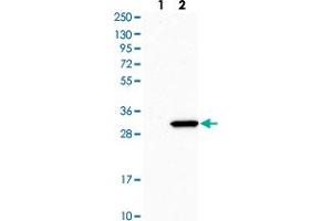 Western blot analysis of Lane 1: Human cell line RT-4 Lane 2: Human cell line U-251MG sp with RPL8 polyclonal antibody  at 1:500-1:1000 dilution. (RPL8 抗体)