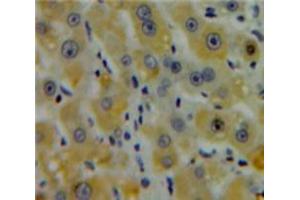 Used in DAB staining on fromalin fixed paraffin-embedded Liver tissue (CENPE 抗体  (AA 2450-2590))