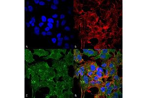 Immunofluorescence (fixed cells) (IF/ICC) image for anti-Glutamate Receptor, Ionotropic, N-Methyl D-Aspartate 2a (GRIN2A) (AA 75-325) antibody (Biotin) (ABIN2483896)