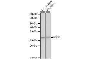 Western blot analysis of extracts of various cell lines, using BNIP1 Rabbit mAb (ABIN7265867) at 1:1000 dilution.