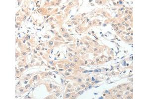 Immunohistochemistry (IHC) image for anti-Neuropeptide Y (NPY) (AA 1-97) antibody (ABIN3017529)