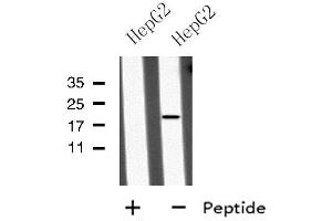 Western blot analysis of MID1IP1 using HepG2 whole cell lysates (m1ip1 抗体  (Internal Region))