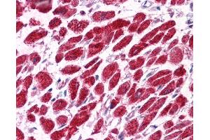 Immunohistochemistry (IHC) image for anti-Vacuolar-sorting Protein SNF8 (SNF8) (N-Term) antibody (ABIN2777341) (SNF8 抗体  (N-Term))