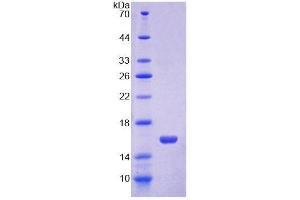SDS-PAGE analysis of Mouse Occludin Protein. (Occludin Protein (OCLN))
