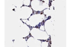 ABIN6268734 at 1/100 staining human Bone marrow tissue sections by IHC-P. (RUNX2 抗体  (Internal Region))