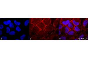 Immunocytochemistry/Immunofluorescence analysis using Rabbit Anti-RAS Polyclonal Antibody .