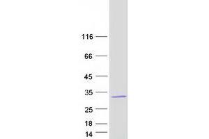 Western Blotting (WB) image for Serine/threonine/tyrosine Interacting Protein (STYX) (Transcript Variant 2) protein (Myc-DYKDDDDK Tag) (ABIN2732919)
