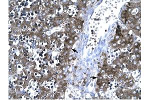 MMP19 antibody was used for immunohistochemistry at a concentration of 4-8 ug/ml to stain Hepatocytes (arrows) in Human Liver. (MMP19 抗体  (C-Term))