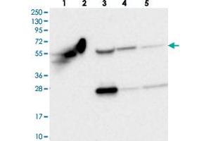 Western blot analysis of Lane 1: RT-4, Lane 2: U-251 MG, Lane 3: Human Plasma, Lane 4: Liver, Lane 5: Tonsil with OTUD1 polyclonal antibody  at 1:250-1:500 dilution. (OTUD1 抗体)