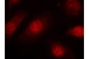 Immunofluorescent staining of methanol-fixed Hela cells using RB1 (phospho S780) polyclonal antibody  at 1:100-1:200 dilution. (Retinoblastoma 1 抗体  (pSer780))