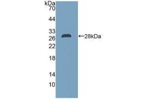 Detection of Recombinant DDAH2, Human using Polyclonal Antibody to Dimethylarginine Dimethylaminohydrolase 2 (DDAH2) (DDAH2 抗体  (AA 31-265))