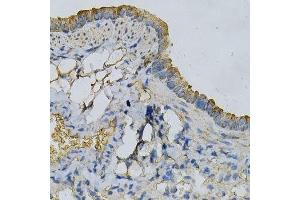 Immunohistochemistry of paraffin-embedded mouse lung using APRT Antibody. (APRT 抗体  (AA 1-180))