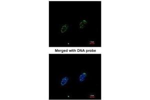 ICC/IF Image Immunofluorescence analysis of paraformaldehyde-fixed HeLa, using RPA 70 kDa subunit , antibody at 1:200 dilution. (RPA1 抗体  (C-Term))