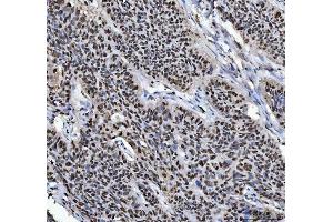 IHC analysis of HNRNPL using anti-HNRNPL antibody (ABIN4886624).