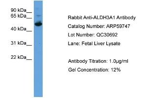 WB Suggested Anti-ALDH3A1  Antibody Titration: 0.