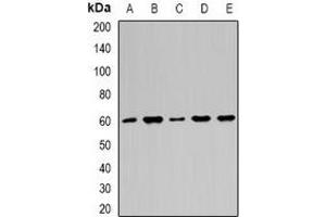 Western blot analysis of Importin alpha 1 expression in HepG2 (A), Hela (B), A549 (C), mouse brain (D), mouse heart (E) whole cell lysates. (KPNA2 抗体)