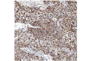 IHC analysis of VAPB using anti-VAPB antibody (ABIN5693292). (VAPB 抗体  (AA 2-55))