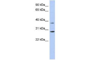 WB Suggested Anti-HOXC5 Antibody Titration:  0. (Homeobox C5 抗体  (Middle Region))