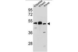 BTBD17 Antibody (C-term) western blot analysis in mouse bladder,heart,liver tissue lysates (35µg/lane). (BTBD17 抗体  (C-Term))