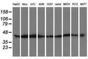 Image no. 2 for anti-ATG3 Autophagy Related 3 (ATG3) antibody (ABIN1496761) (ATG3 抗体)