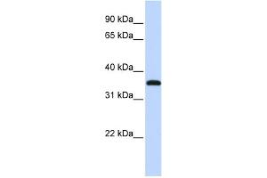 WB Suggested Anti-VGLL3 Antibody Titration: 0. (VGLL3 抗体  (Middle Region))