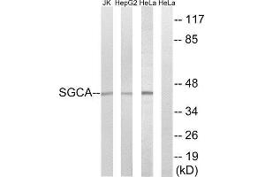 Western Blotting (WB) image for anti-Sarcoglycan, alpha (50kDa Dystrophin-Associated Glycoprotein) (SGCA) (Internal Region) antibody (ABIN1850735) (SGCA 抗体  (Internal Region))