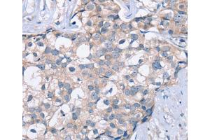 Immunohistochemistry (IHC) image for anti-Potassium Voltage-Gated Channel, KQT-Like Subfamily, Member 5 (KCNQ5) antibody (ABIN2423696) (KCNQ5 抗体)