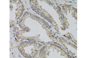 Immunohistochemistry of paraffin-embedded Human prostate using VIP Polyclonal Antibody (Vip 抗体)