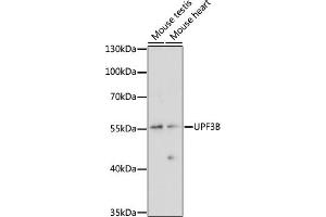 Western blot analysis of extracts of various cell lines, using UPF3B antibody (ABIN7271228) at 1:1000 dilution. (UPF3B 抗体  (AA 1-180))