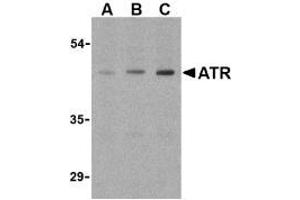 Image no. 2 for anti-anthrax Toxin Receptor 1 (ANTXR1) (Internal Region) antibody (ABIN205769) (ANTXR1 抗体  (Internal Region))
