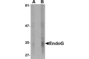 Western Blotting (WB) image for anti-Endonuclease G (ENDOG) (AA 51-140) antibody (ABIN492524) (Endonuclease G 抗体  (AA 51-140))
