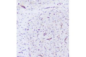 IHC analysis of INPPL1 using anti-INPPL1 antibody (ABIN6719492). (INPPL1 抗体  (AA 1172-1258))