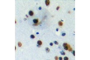Immunohistochemical analysis of PIAS4 staining in human brain formalin fixed paraffin embedded tissue section. (PIAS4 抗体  (C-Term))