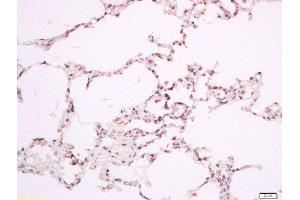 Paraformaldehyde-fixed, paraffin embedded rat lung, Antigen retrieval by boiling in sodium citrate buffer (pH6) for 15min, Block endogenous peroxidase by 3% hydrogen peroxide for 30 minutes, Blocking buffer (normal goat serum) at 37°C for 20min, Antibody incubation with Rabbit Anti-ILK-1(Thr173) Polyclonal Antibody, Unconjugated  at 1:200 overnight at 4°C, followed by a conjugated secondary for 90 minutes and DAB staining. (ILK 抗体  (pThr173))