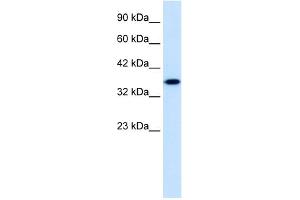 WB Suggested Anti-ZNF75 Antibody Titration:  1. (ZNF75 抗体  (Middle Region))